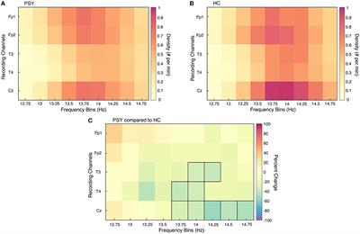 Sleep spindles across youth affected by schizophrenia or anti-N-methyl-D-aspartate-receptor encephalitis